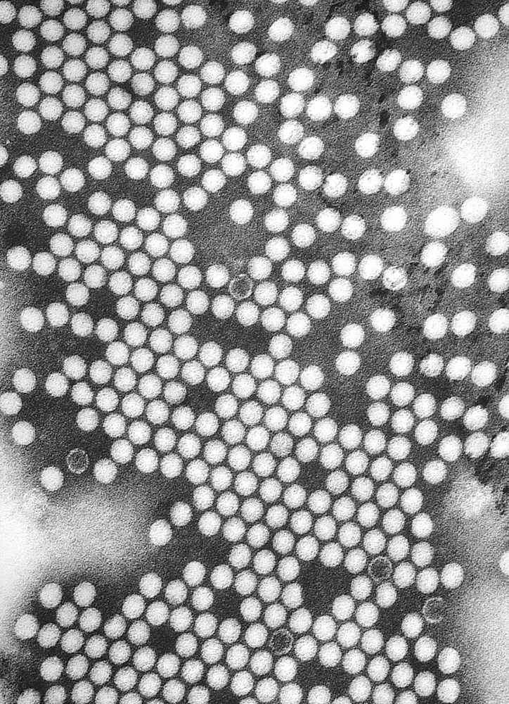 Transmission electron microscopy