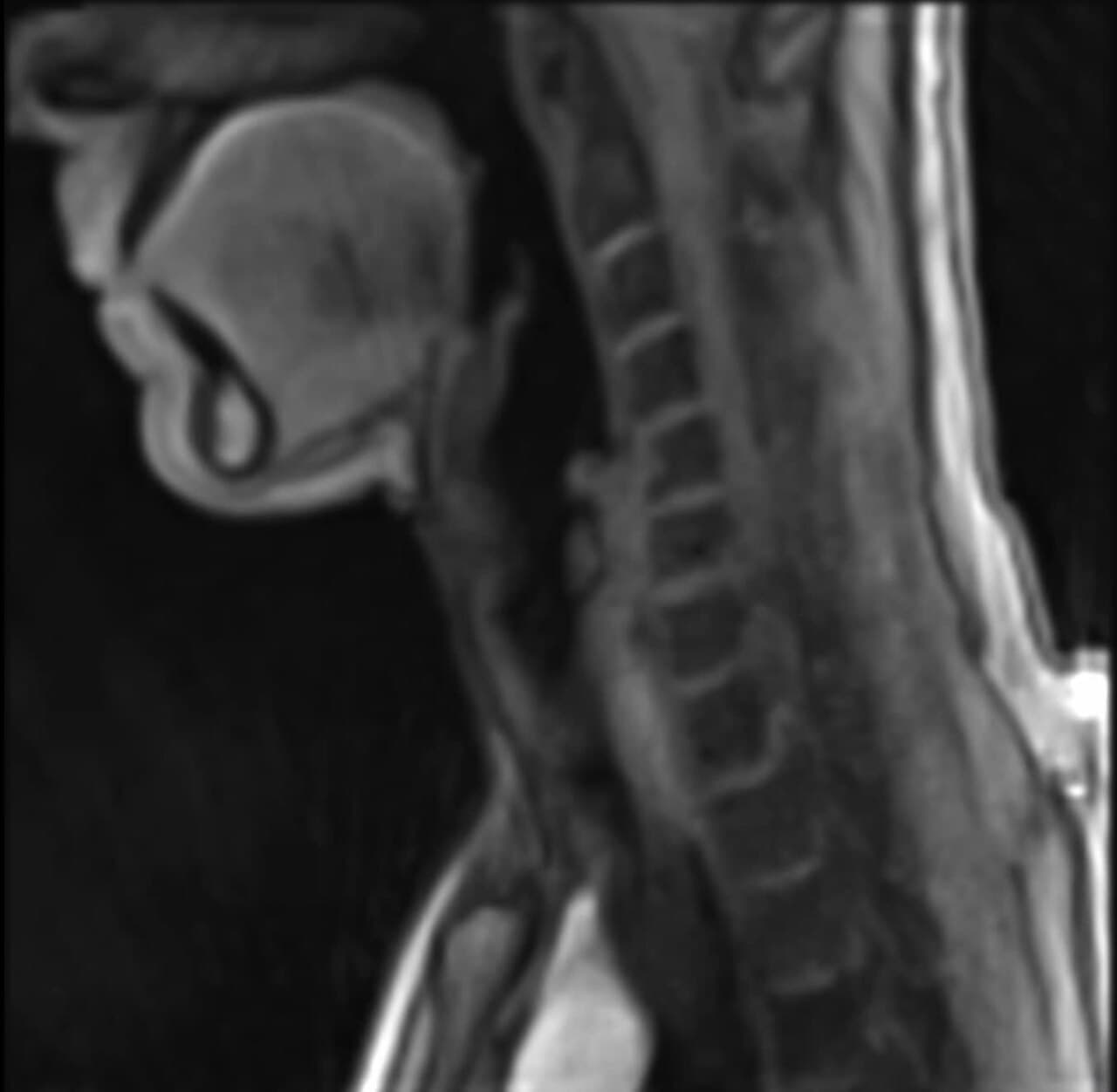 MRI contrast agent